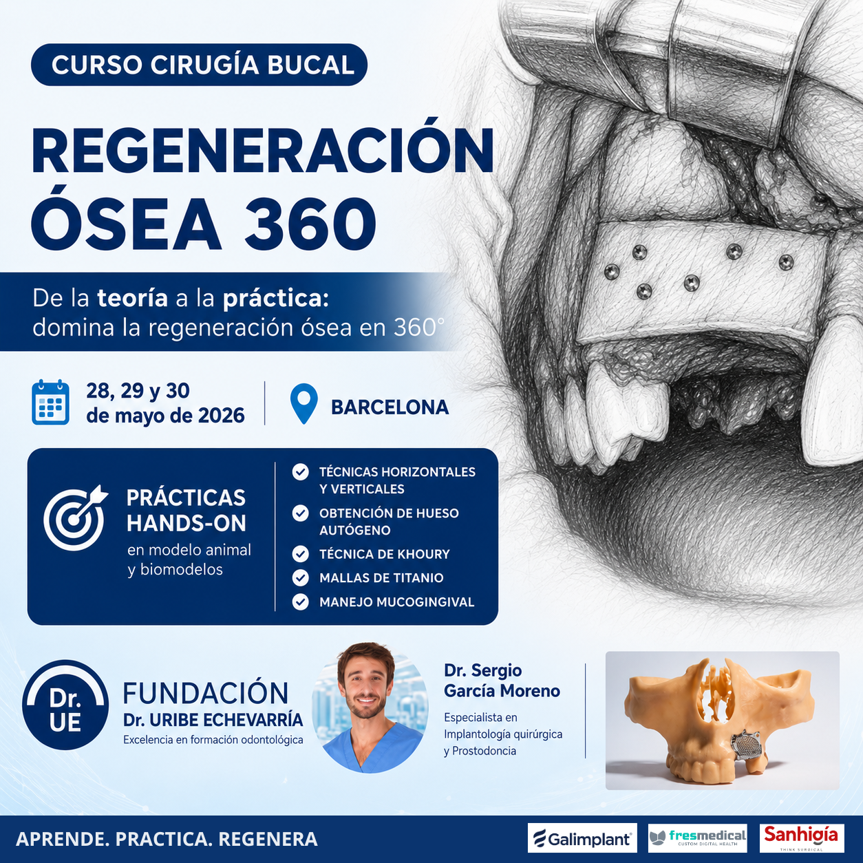CURSO CIRUGÍA BUCAL: Regeneración Ósea 360º
